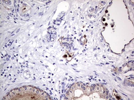 Monoclonal Mouse anti-Human CEACAM5 / CD66e Antibody (clone OTI3D8, aa35-680, IHC, WB)