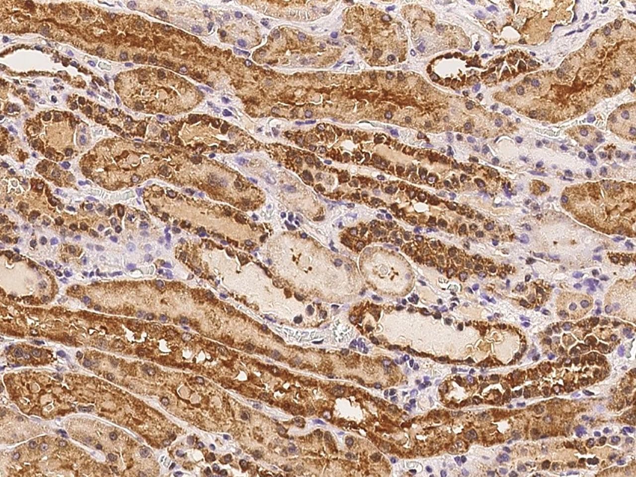 RRP36 Antibody
