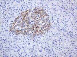 CD99 Antibody (clone OTI1F1)