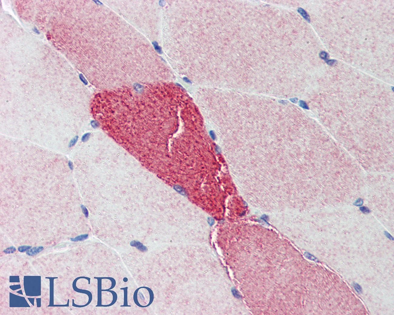 IHC-plus™ Polyclonal Rabbit anti-Human PIGY Antibody (IHC, IF, WB)