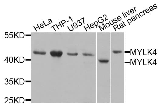 Polyclonal Rabbit anti-Human MYLK4 Antibody (WB)