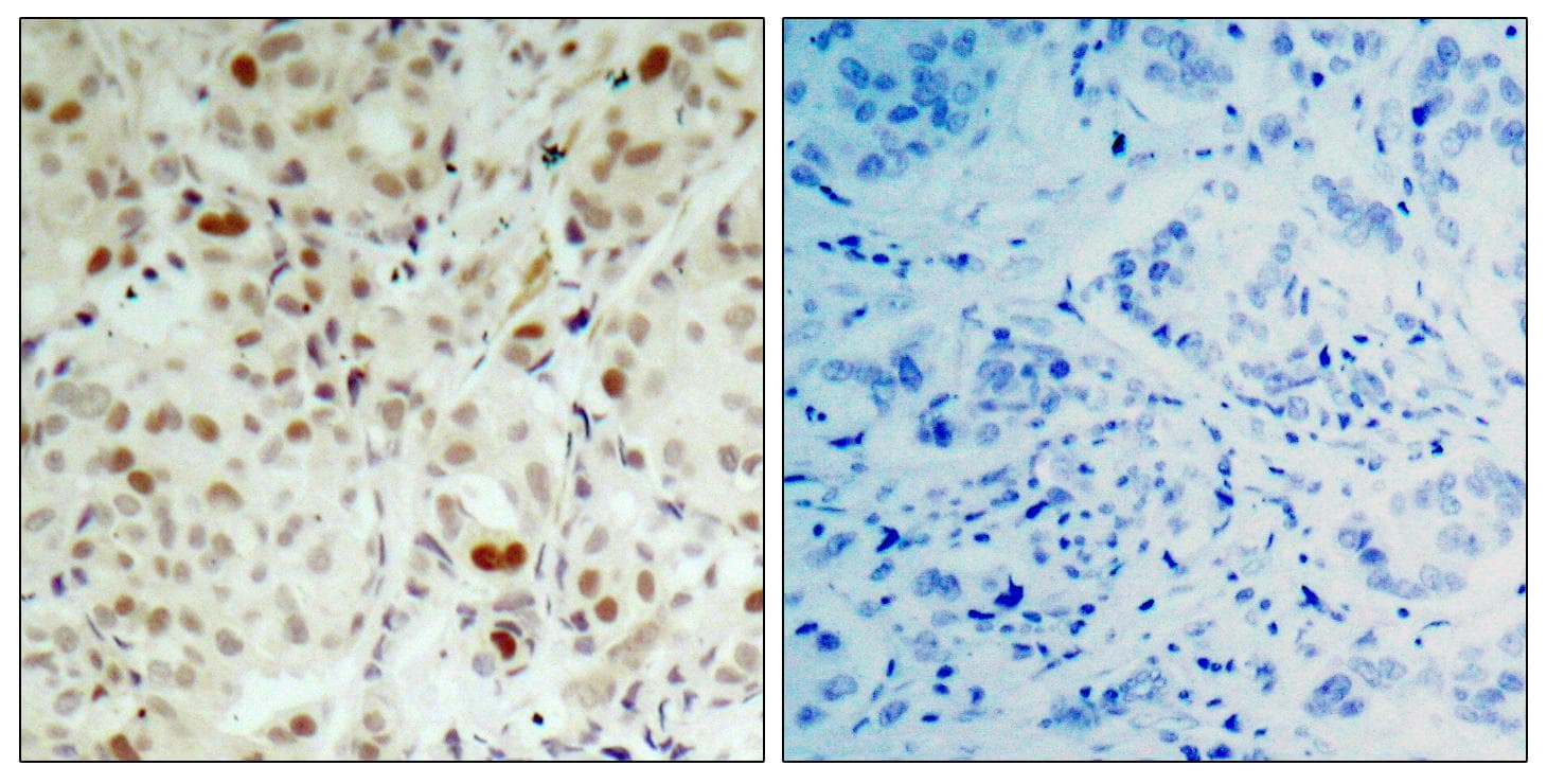 Polyclonal Rabbit anti-Human RB1 / Retinoblastoma / RB Antibody (phospho-Ser807, IHC, WB)
