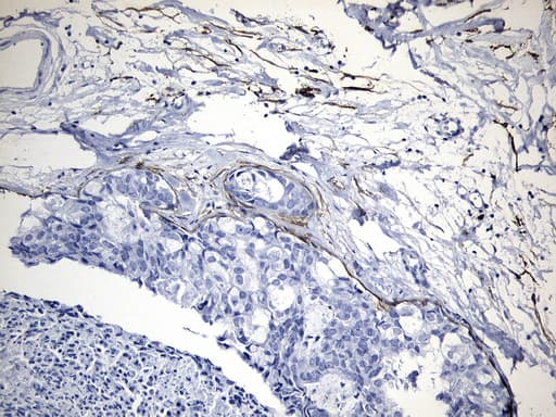 MME / CD10 Antibody (aa411-750, clone UMAB235)