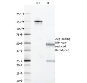 Monoclonal Mouse anti-Human MAML2 Antibody (clone MAML2/1302, Azide-free,BSA-free, IHC, IF, WB)