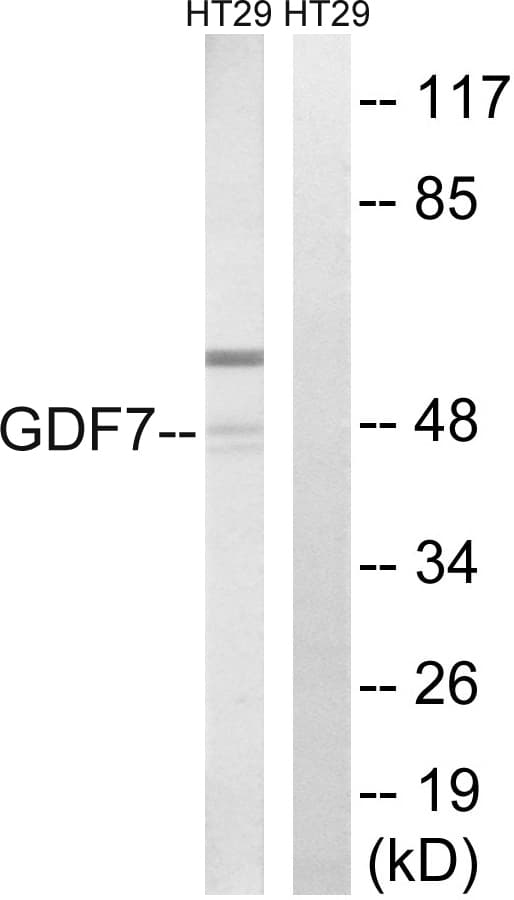 Polyclonal Rabbit anti-Human BMP12 / GDF7 Antibody (aa191-240, WB)