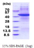 Human TARBP2 / TRBP2 Protein (Recombinant)