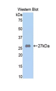 A2M / Alpha-2-Macroglobulin Antibody (aa818-1048)
