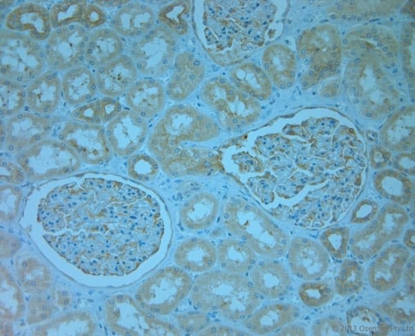 Polyclonal Rabbit anti-Human REEP5 Antibody (aa150-189, IHC)