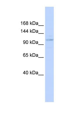 ST18 Antibody (aa899-948)