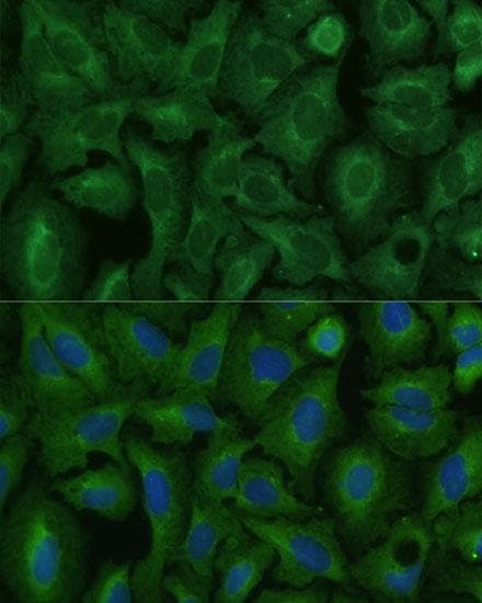 Polyclonal Rabbit anti-Human TIMM8B Antibody (IHC, IF)