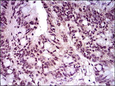 TBXT / T / Brachyury Antibody (aa 257-309, clone 1H9A2)