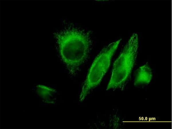 SPRY2 / Sprouty 2 Antibody (clone 1E10)