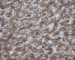 Monoclonal Mouse anti-Human NPR3 Antibody (clone OTI11H6, IHC, IF, WB)