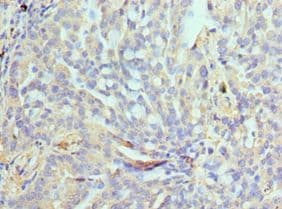 NPR2L / TUSC4 Antibody (aa1-220)