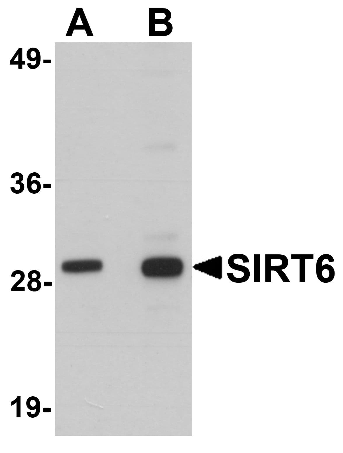 SIRT6 / Sirtuin 6 Antibody