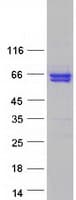 Human SCAI Protein (Recombinant Myc-DDK (Flag))