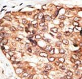 STAT5B Antibody (aa760-787)