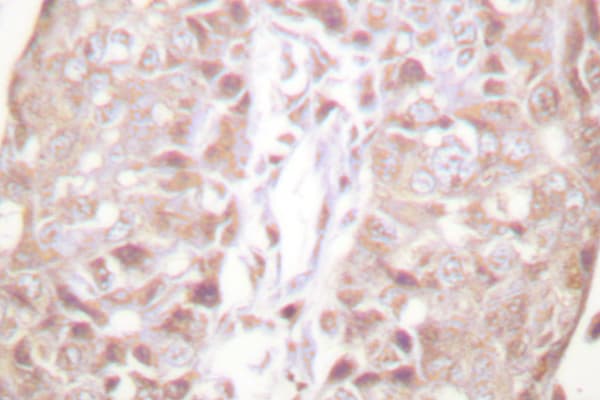 SENP1 Antibody (Asp2)