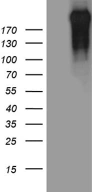 POLR2A / RNA polymerase II Antibody (aa1351-1614, clone OTI2B7)