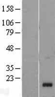 RARRES2 / Chemerin Protein (Over-Expression Lysate Myc-DDK (Flag))