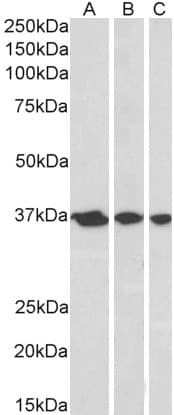 IHC-plus™ APEX1 / APE1 Antibody (aa2-15)