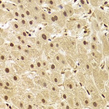 PHAP1 / ANP32A Antibody