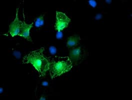 ARH / LDLRAP1 Antibody (clone OTI3H10)