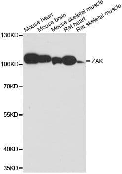 ZAK / MLTK Antibody