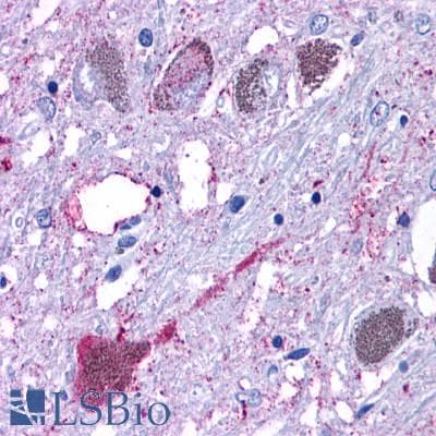 PathPlus™ Polyclonal Rabbit anti-Human GPR6 Antibody (C-Terminus, IHC)