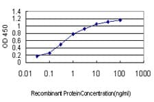 Monoclonal Mouse anti-Human CSF1R / CD115 / FMS Antibody (clone 1G4, WB)