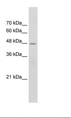 CHRNB2 Antibody (aa155-204)