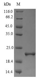 FXN / Frataxin Protein (Recombinant 10His, N-terminus)