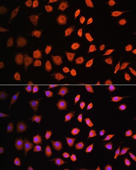 CDK6 Antibody