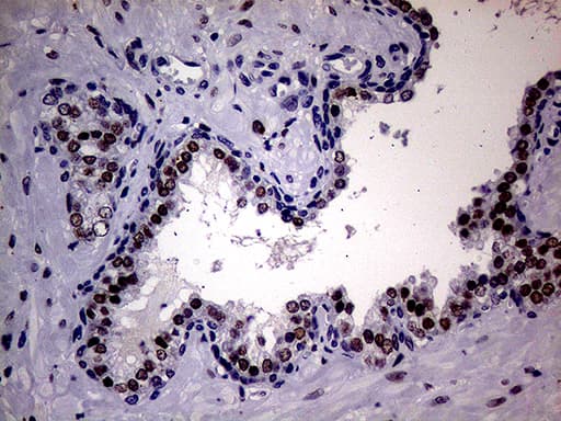 AR / Androgen Receptor Antibody (aa420-659, clone OTI2E11)