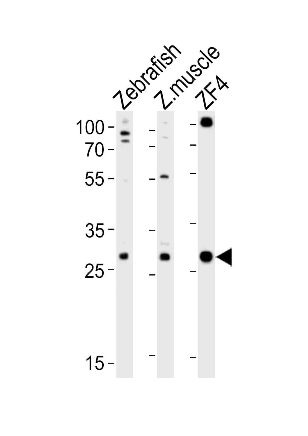 AK2 / Adenylate Kinase 2 Antibody (aa2-36)