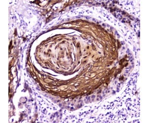 E-FABP / FABP5 Antibody