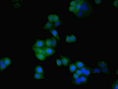 IHC-plus™ SDHA Antibody