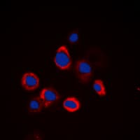 IHC-plus™ EGFR Antibody (Internal)