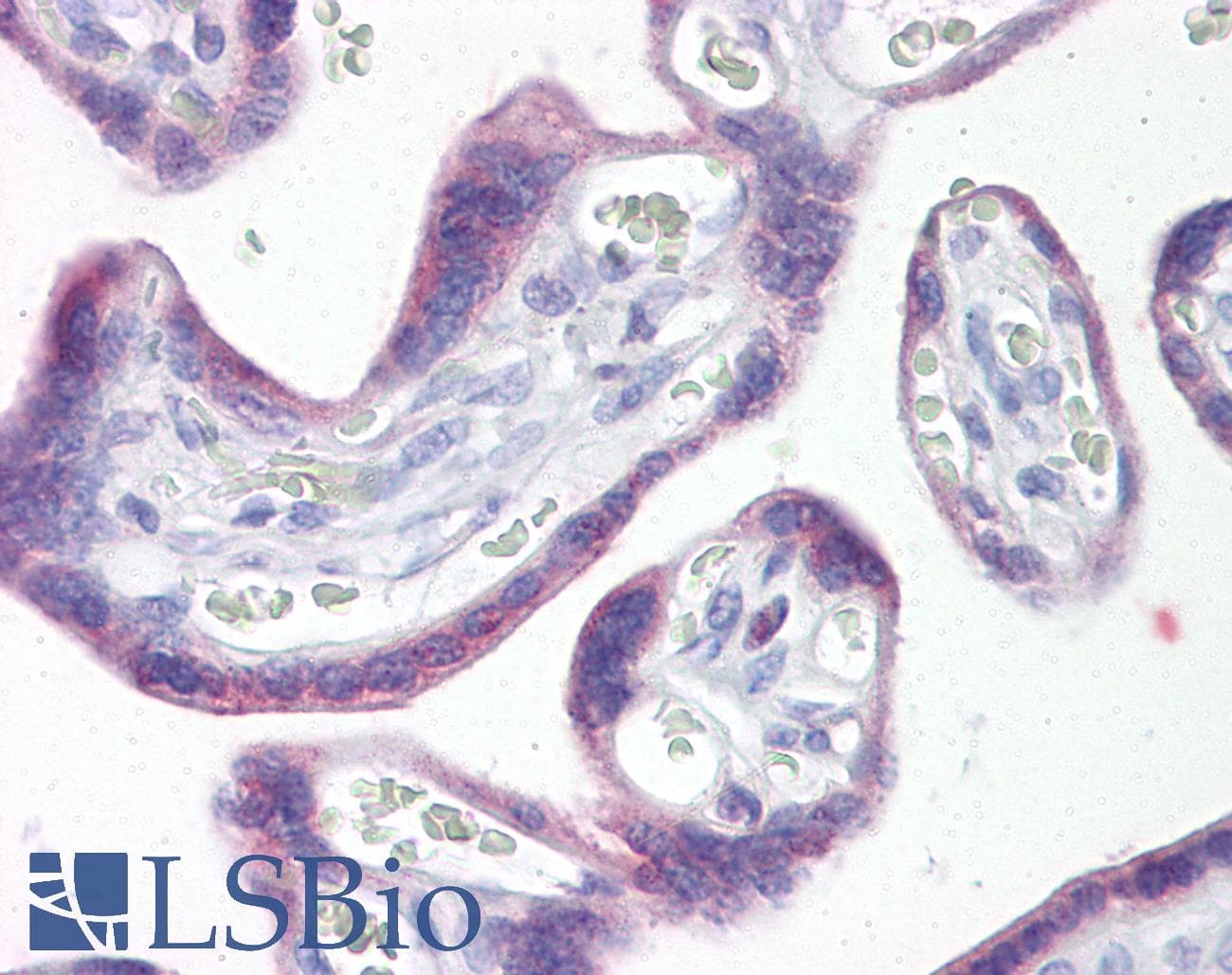 IHC-plus™ SNAI1 / SNAIL-1 Antibody (aa80-130)