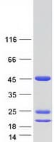 Human ASRGL1 Protein (Recombinant Myc-DDK (Flag))