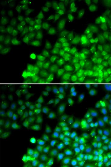 TAGLN2 / Transgelin 2 Antibody