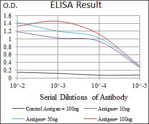 IHC-plus™ ALK3 / BMPR1A Antibody (aa179-378, clone 4B7B2)