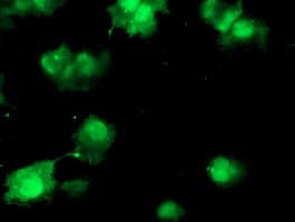 COMMD1 Antibody (clone OTI1G7)