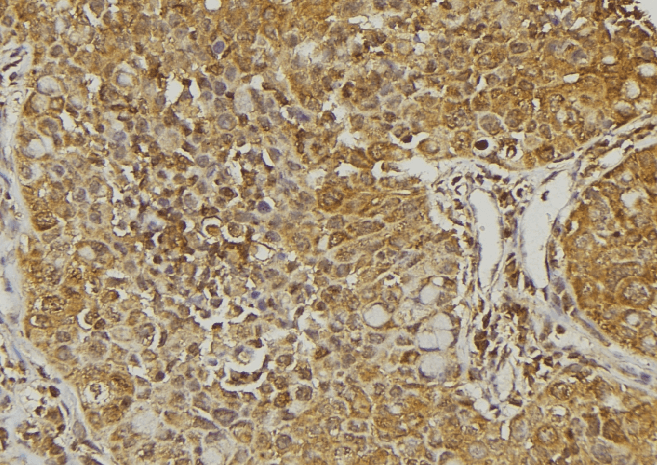 BRAK / CXCL14 Antibody