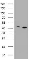 PRR11 Antibody (aa125-360, clone OTI2A10, Carrier-free)