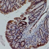 Monoclonal Mouse anti-Human NOS3 / eNOS Antibody (IHC, WB)