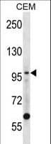 LIG1 / DNA Ligase 1 Antibody (aa1-30)