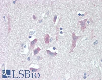 IHC-plus™ TYRO3 Antibody