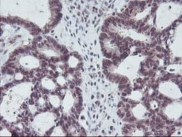 PGAM2 Antibody (clone OTI1C1)