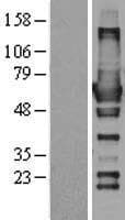 RIC8A Protein (Over-Expression Lysate Myc-DDK (Flag))